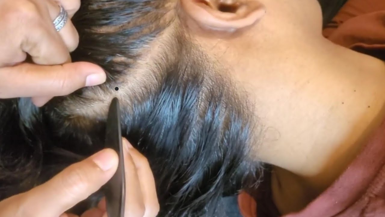 ASMR Scalp Check: The Most Satisfying Treatment & Tapping