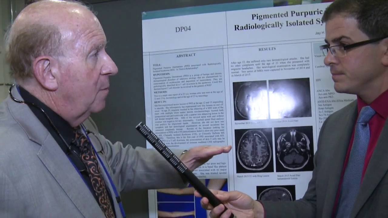 Pigmented Purpuric Dermatosis (PPD) and Radiologically Isolated Syndrome (RIS)