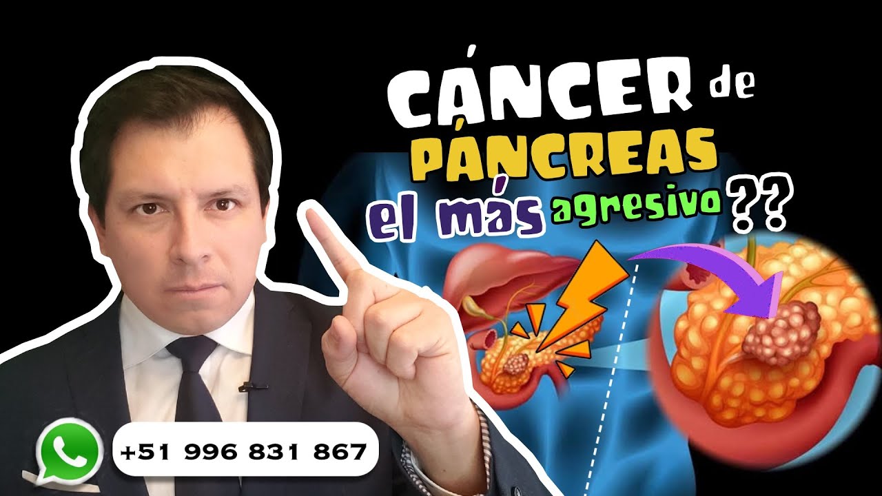 CUIDADO ⚠️ LO QUE DEBEMOS SABER SOBRE EL CÁNCER DE PÁNCREAS !!!