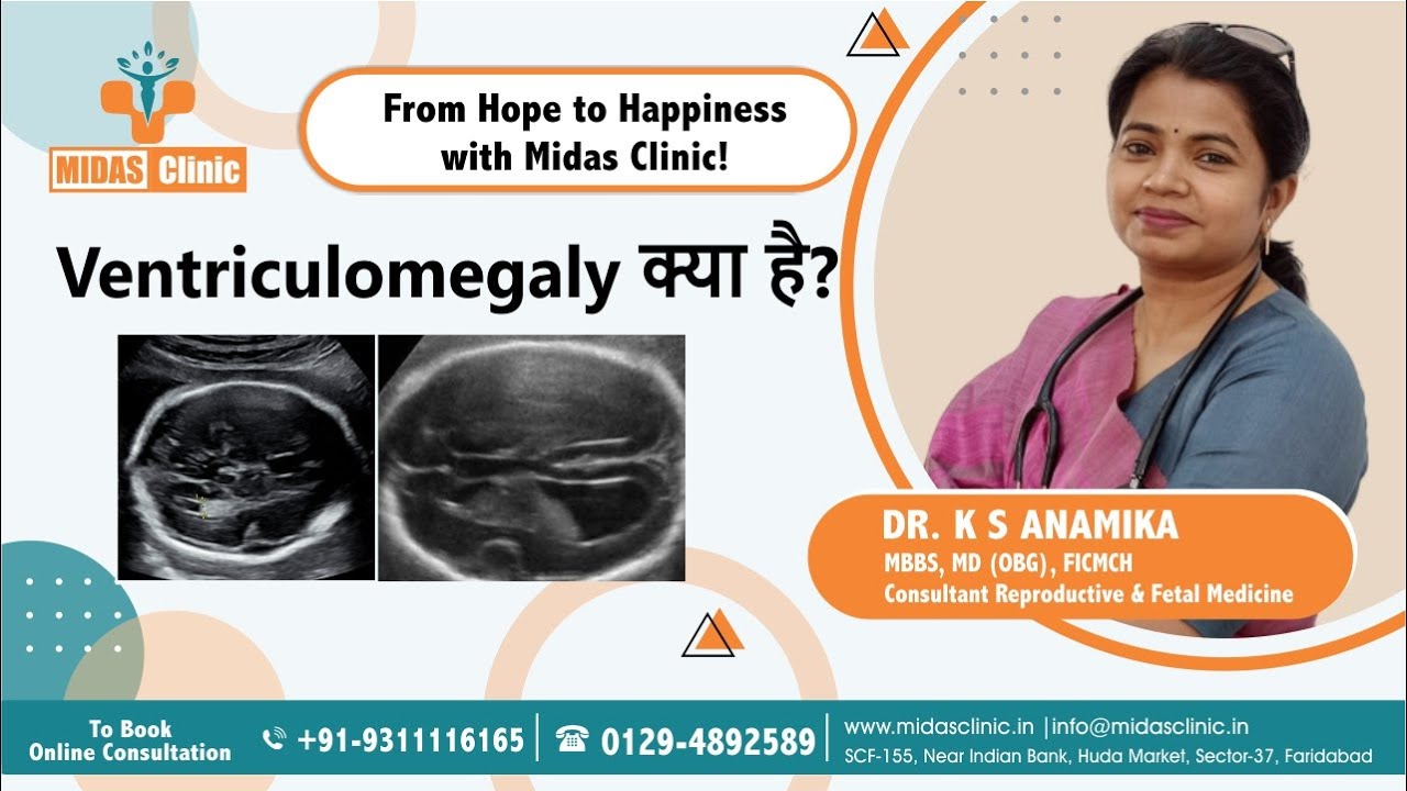 Ventriculomegaly क्या है | Best Gynaecologist in Faridabad | Dr. KS Anamika