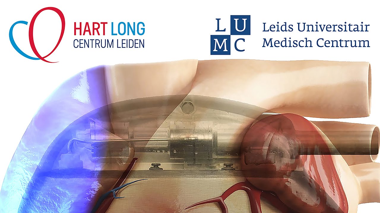 Gentherapie met ge&iuml;mplanteerd LED-lampje stopt hartritmestoornis automatisch