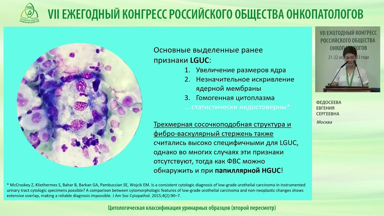 Цитологическая классификация уринарных образцов (второй пересмотр)