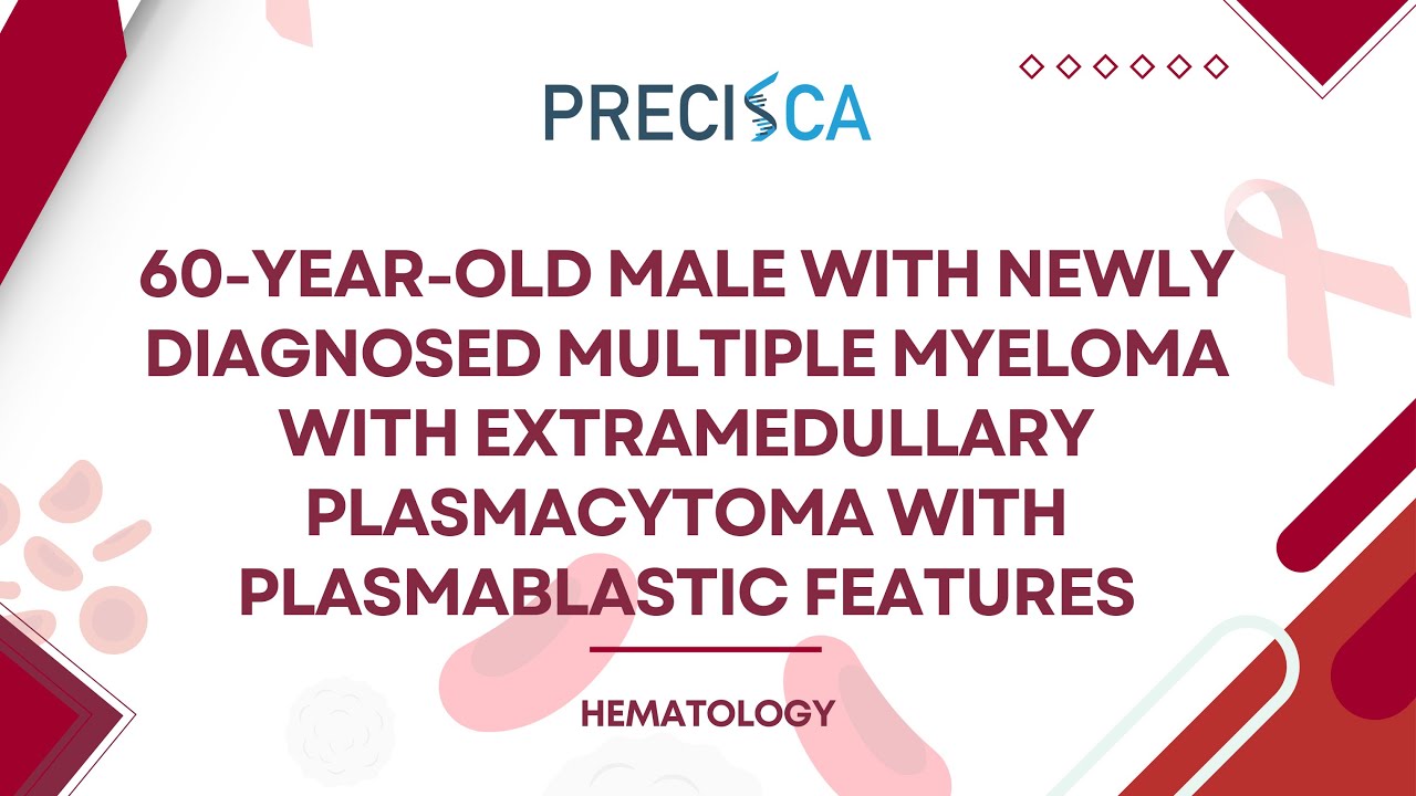 Expert Cancer Panel: Multiple myeloma w/ extramedullary plasmacytoma with plasmablastic features