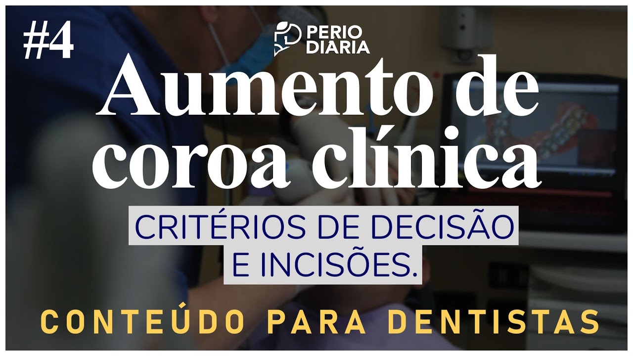 #4 - AUMENTO DE COROA CLÍNICA - critérios de decisão e incisões.