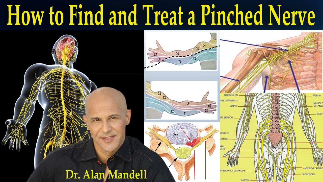 How To Find and Treat a Pinched Nerve (Simple Neurology) - Dr Mandell