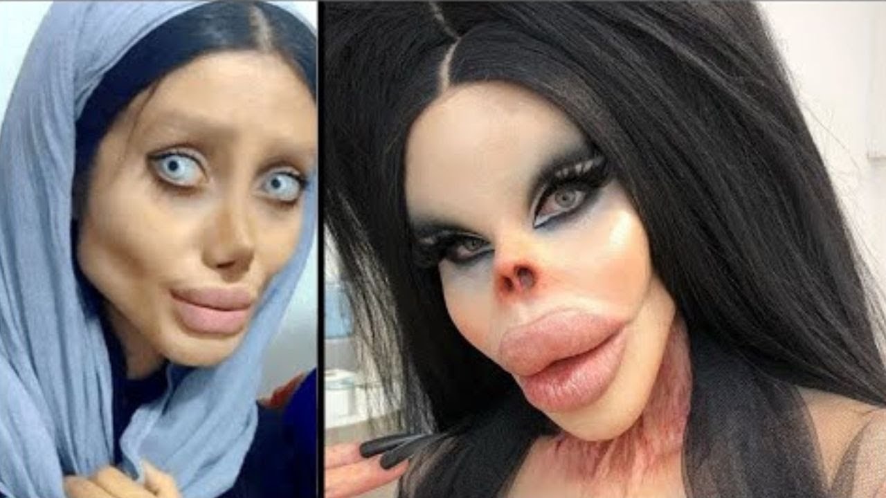 أغرب عمليات التجميل التي تجاوزت كل الحدود.. لن تصدق كيف تحولت أشكالهم!