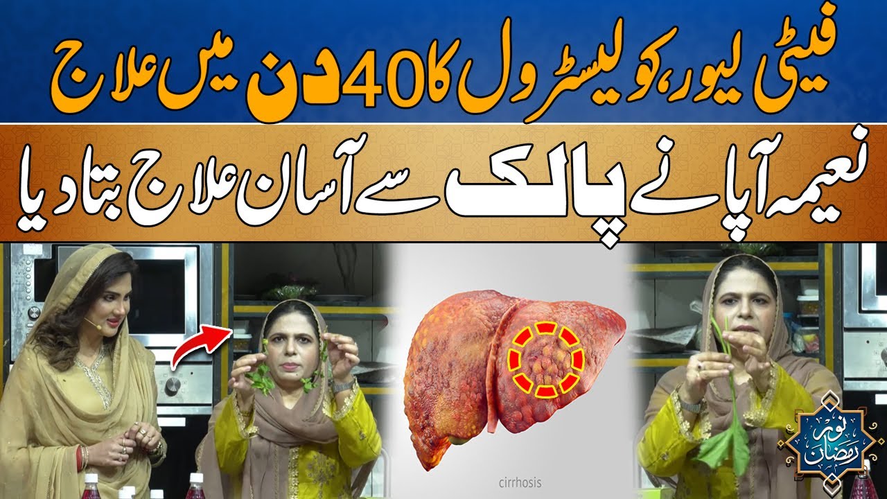 Fatty Liver And Cholesterol Treatment At Home ,, Naeema Apa Share Easy Remedy