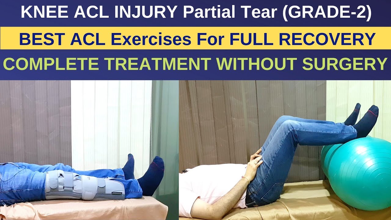 Treatment of ACL Injury Partial Tear-Grade 2, ACL Rehab Exercises Without Surgery- ACL RECOVERY