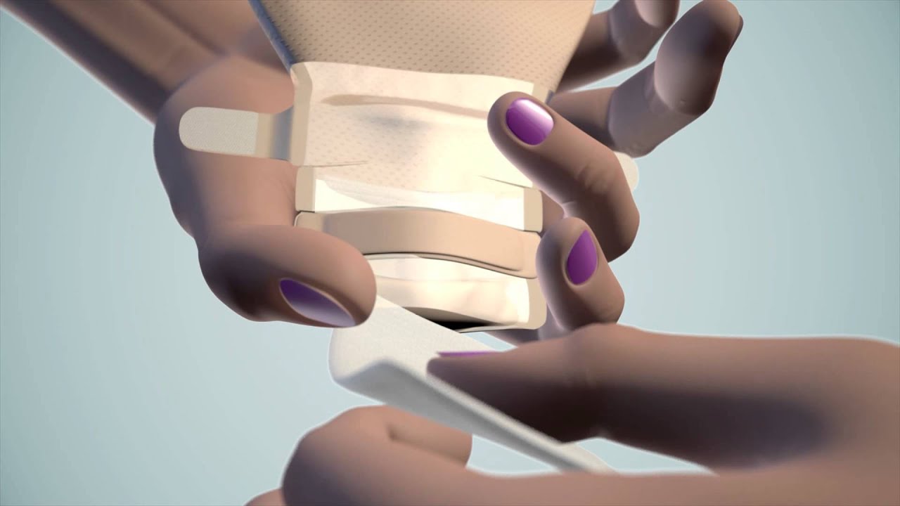 Zdejmowanie i utylizacja worków stomijnych