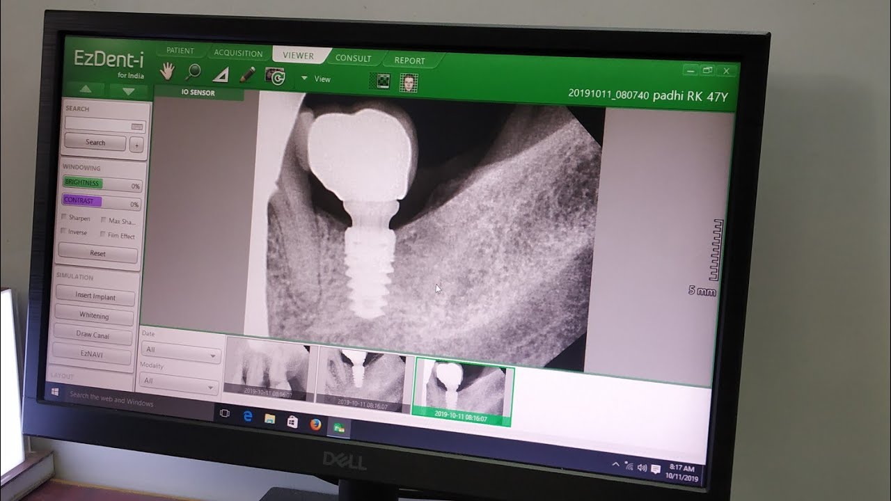 SCOPE OF ORAL SURGERY
