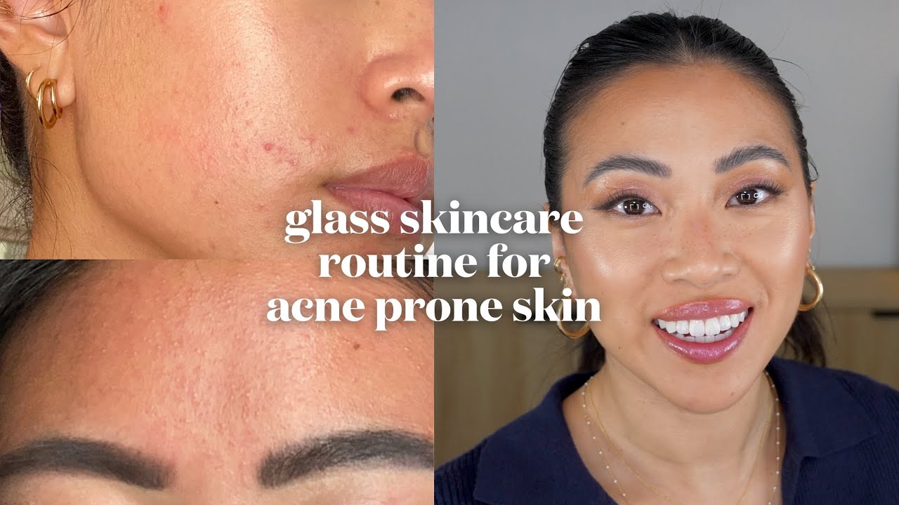 updated skincare routine for glowy and dewy skin as someone with acne