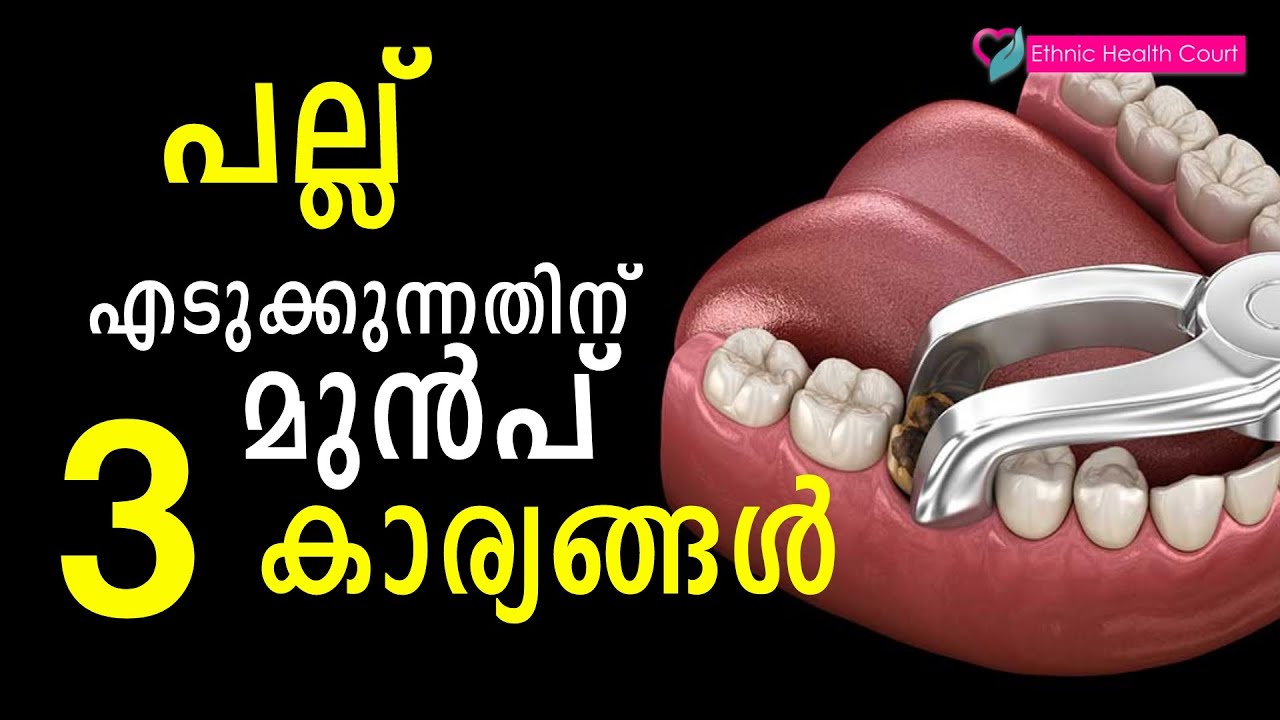 പല്ല് എടുക്കുന്നതിനു മുൻപ്  ശ്രദ്ധിക്കേണ്ട കാര്യങ്ങൾ | pallu edukkal | Ethnic Health Court