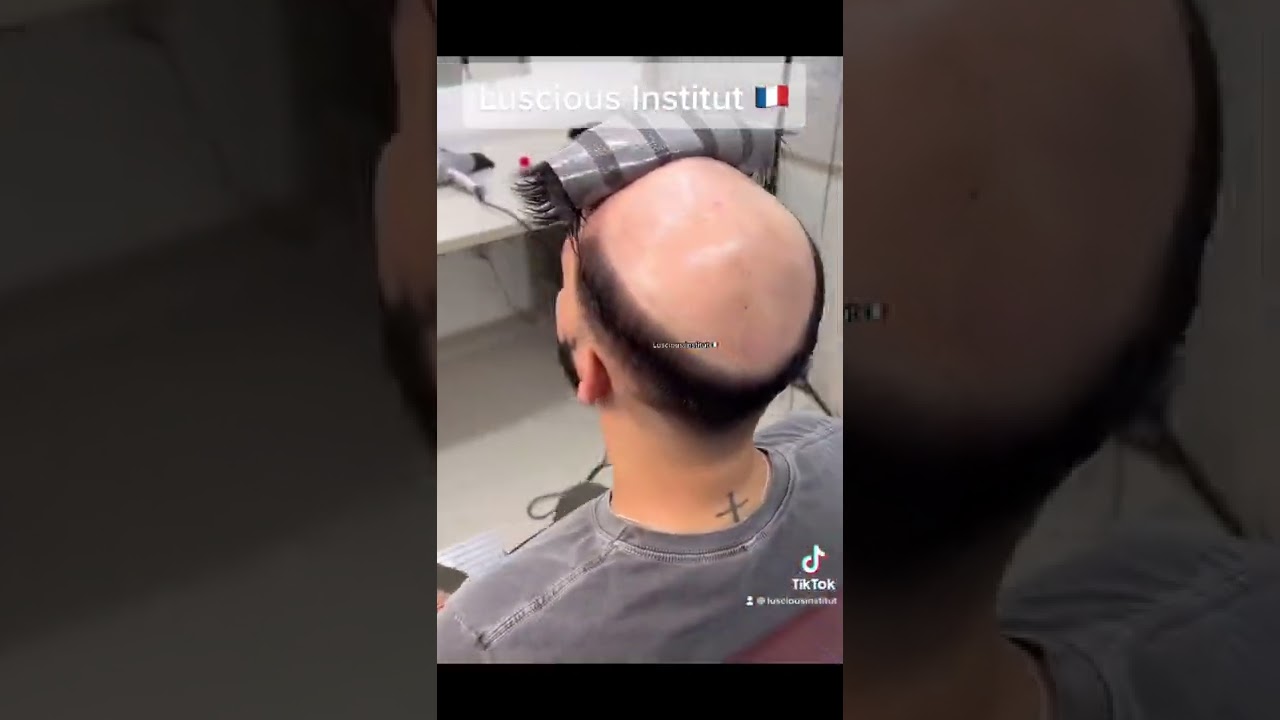 New generation men's wig - Perruque Haut de gamme￼ - Nouvelle g&eacute;n&eacute;ration￼ - Luscious Institut🇫🇷