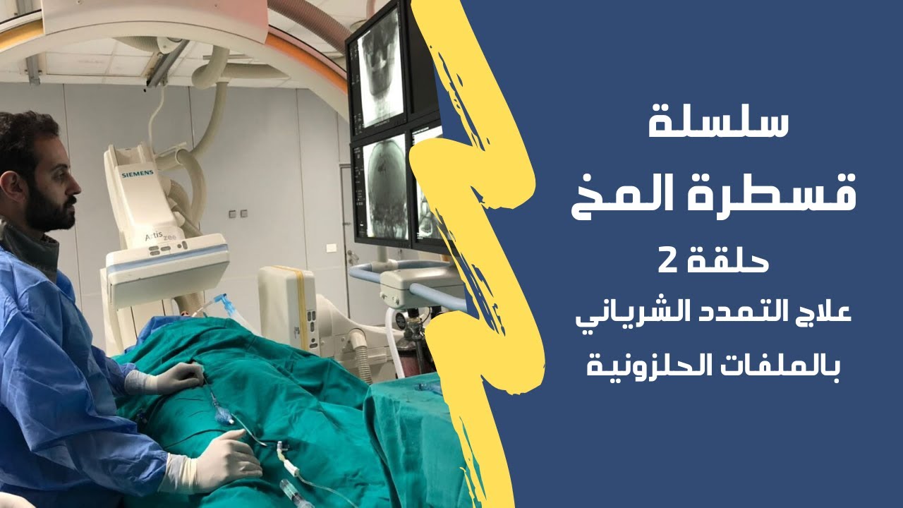 الحلقة ٢ سلسلة قسطرة المخ | د. مصطفي فريد : التمدد الشرياني في المخ و الملفات الحلزونية