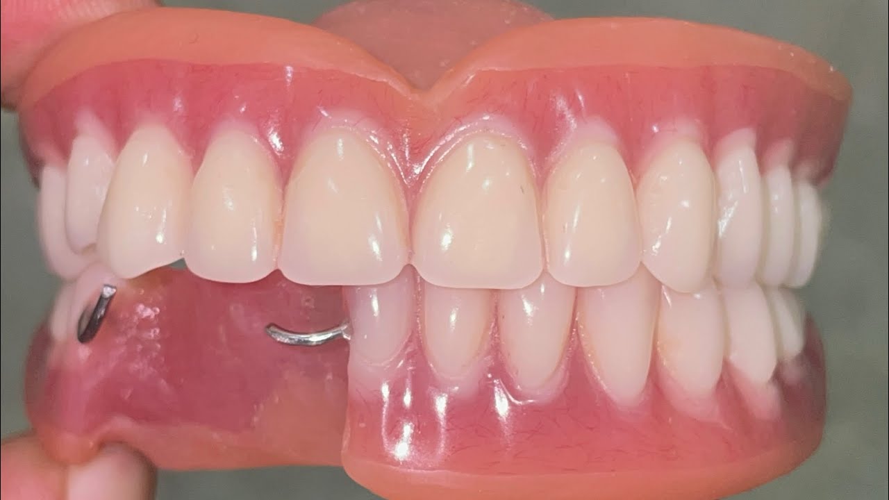 Soft lining dentures Soft dentures use Softlining denture reline 