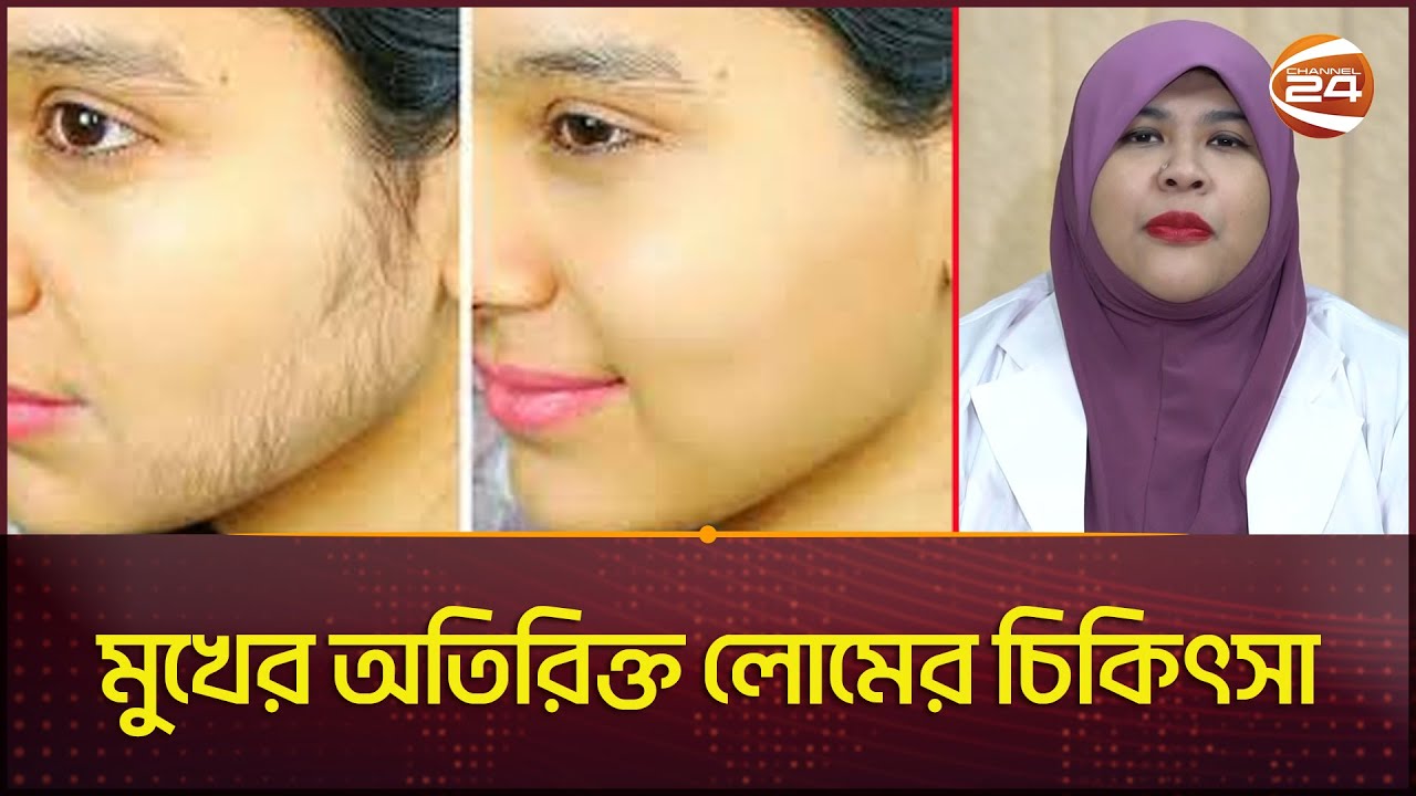 মুখে অতিরিক্ত লোম কেন হয়? | Face Hair Treatment | Doctor's Tips | Channel 24