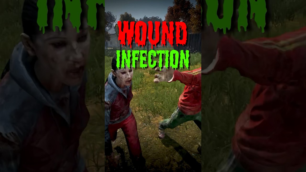 The Worst Way to Die in DayZ&hellip;