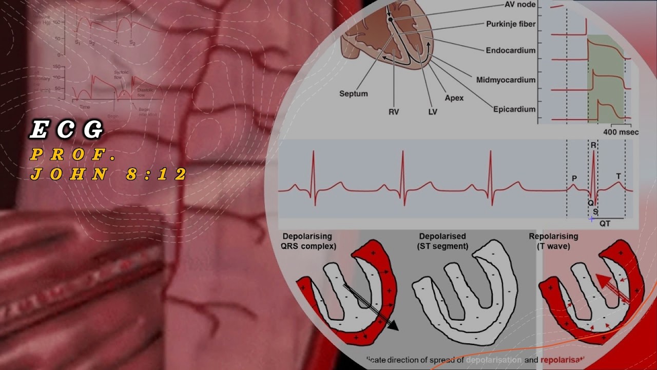 ECG T-Wave Concordance: Repolarization Logic | USMLE Cardiology