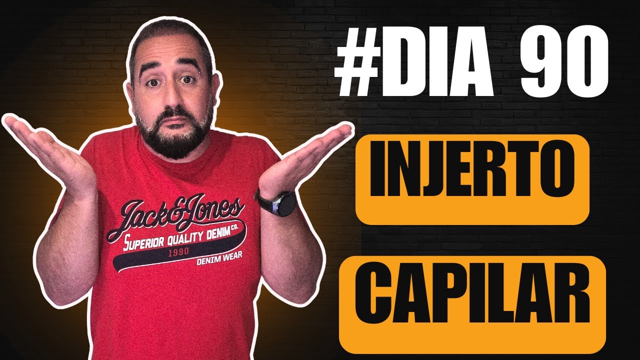 ¿Es normal esto a los 90 días del INJERTO capilar? Te lo muestro