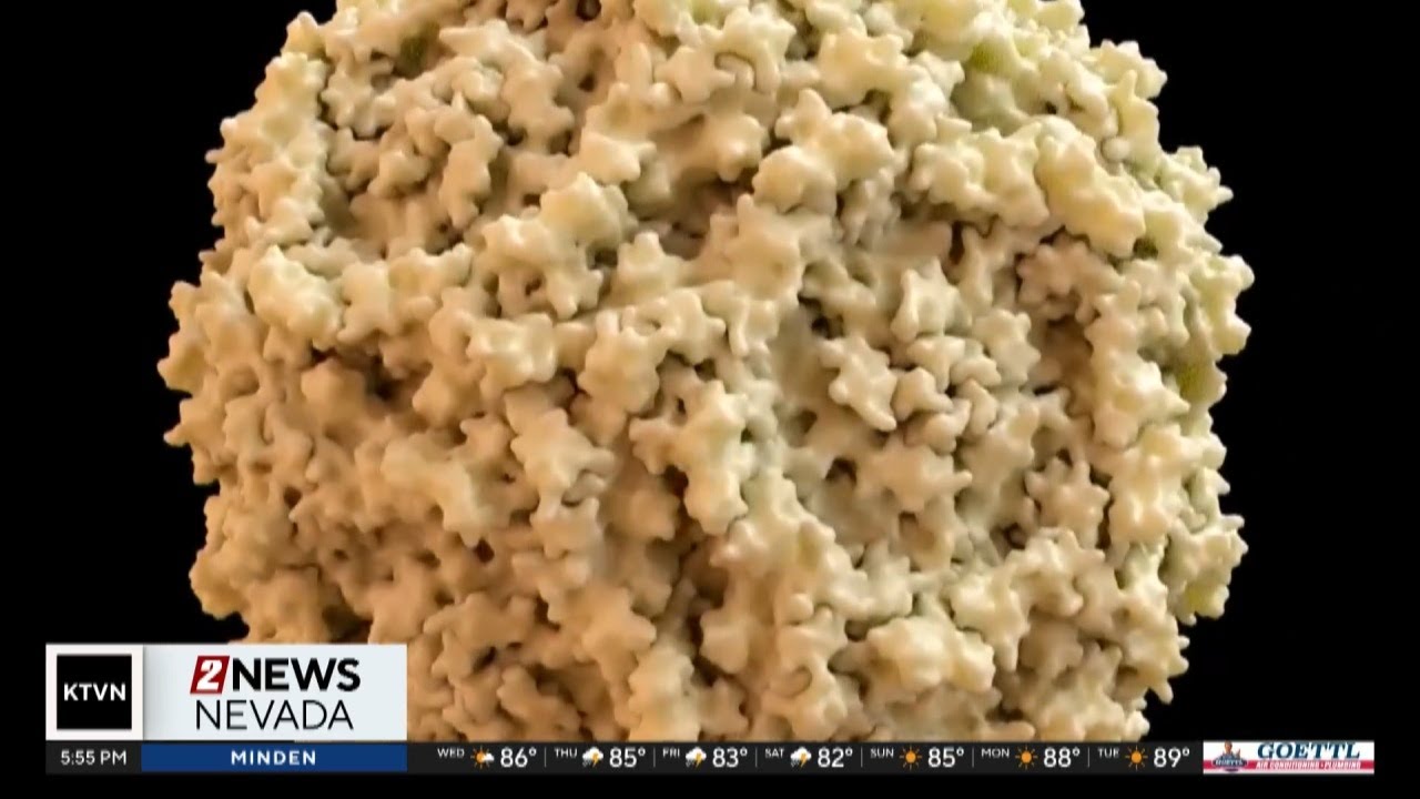 Health Watch: Fifth Disease