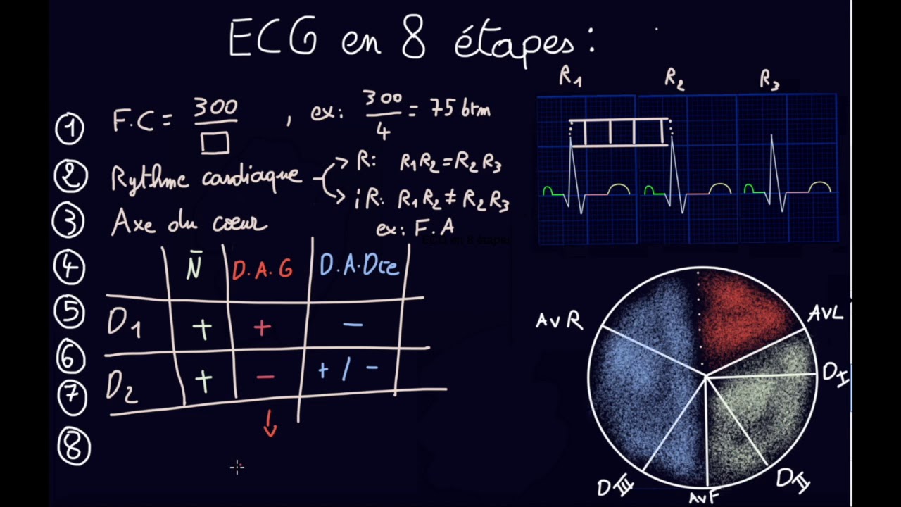 ECG en 8 étapes - Docteur Synapse