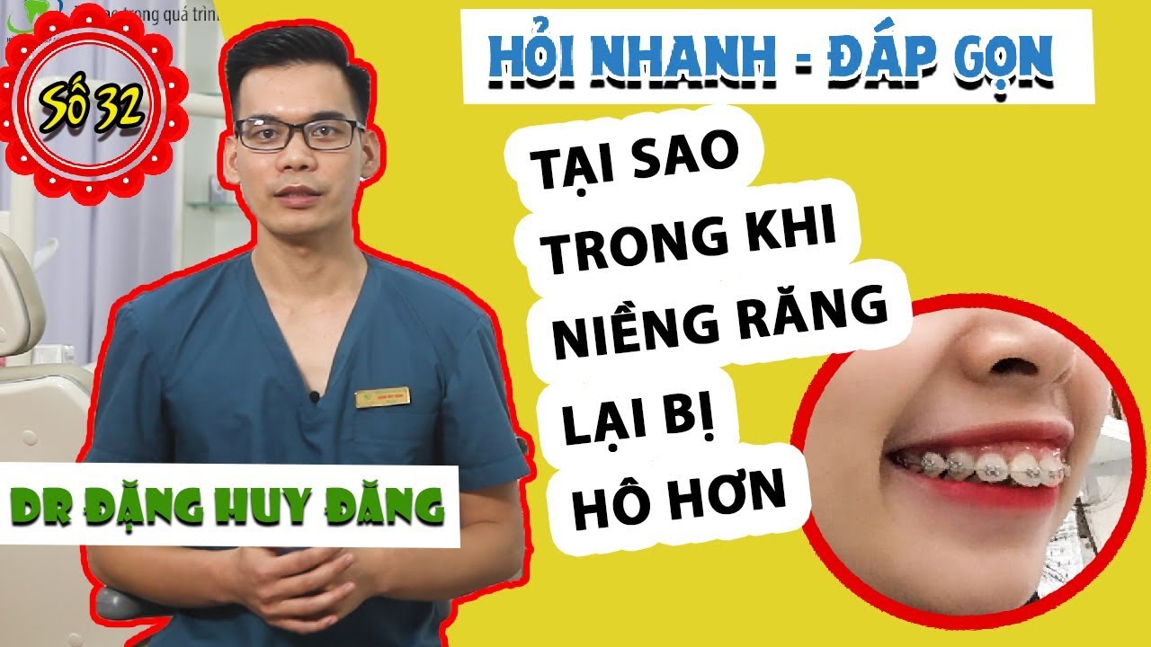 GIẢI THÍCH TẠI SAO NIỀNG RĂNG LẠI BỊ HÔ RA