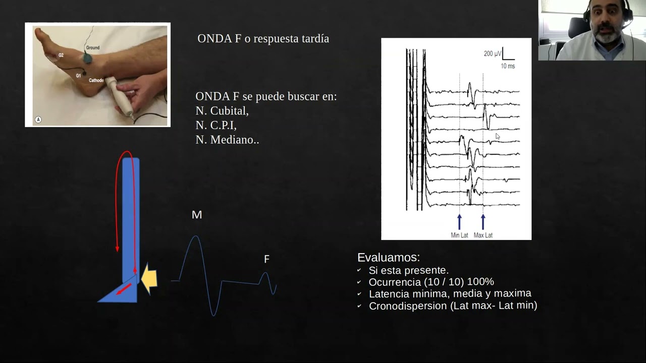 Introduc. monitoreo electrofisiológico normal y patológico en CTI. Periférico. Dr. Hackembruch