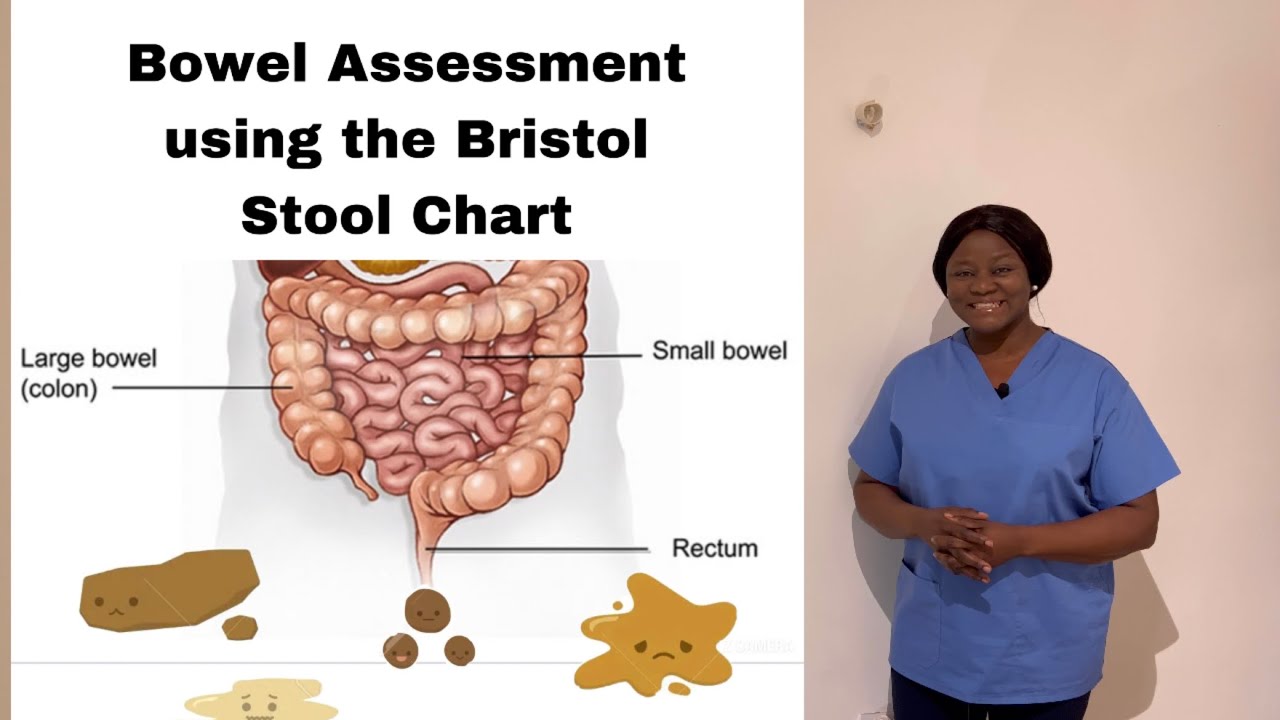 Bowel Assessment using the Bristol Stool Chart.#OSCE #NMCUK New Skill November 2022#Bowel Assessment