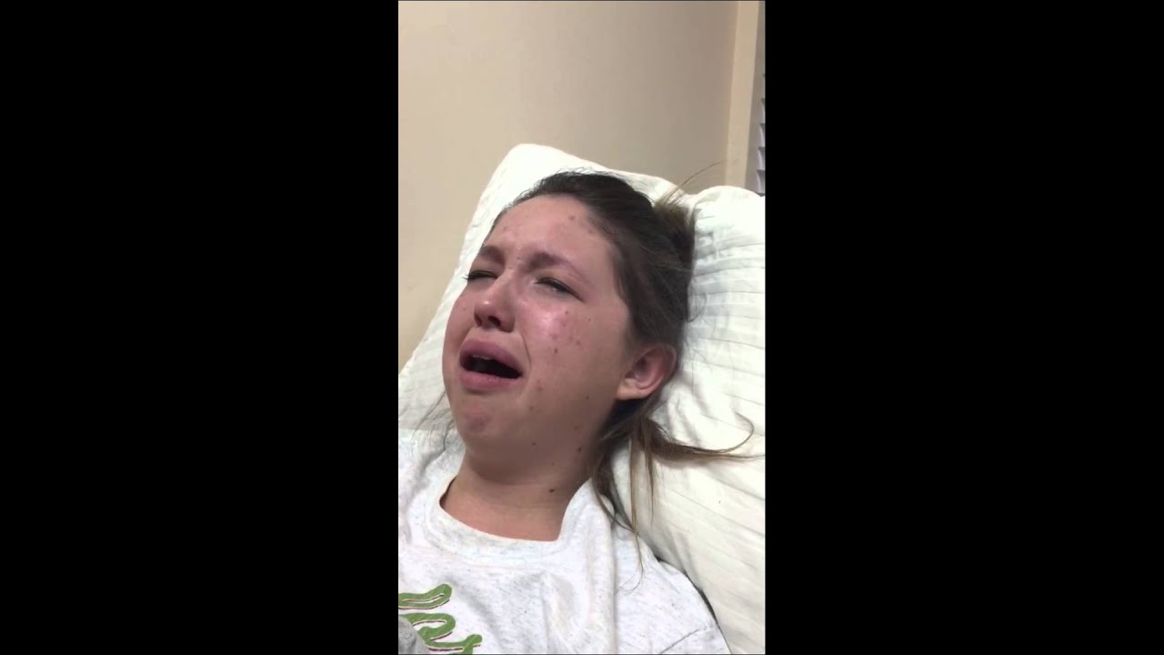 My wisdom teeth removal.