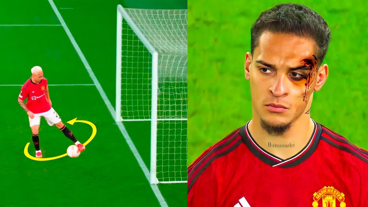 O QUE ACONTECEU COM O ANTONY?