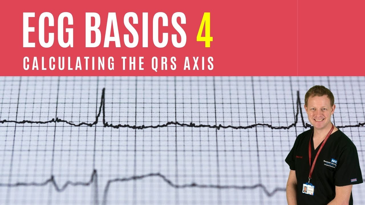 ECG Basics 4: Calculating the QRS axis