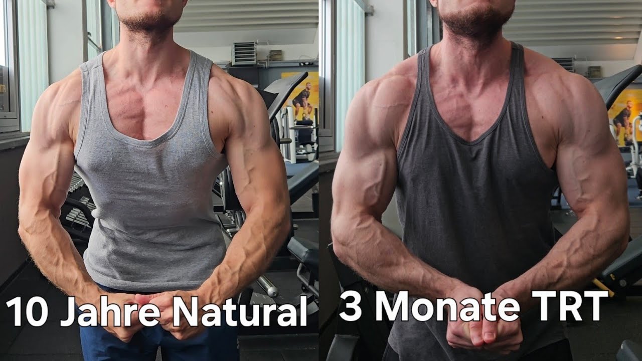 3 Monate TRT vs 10 Jahre Natural Vergleich