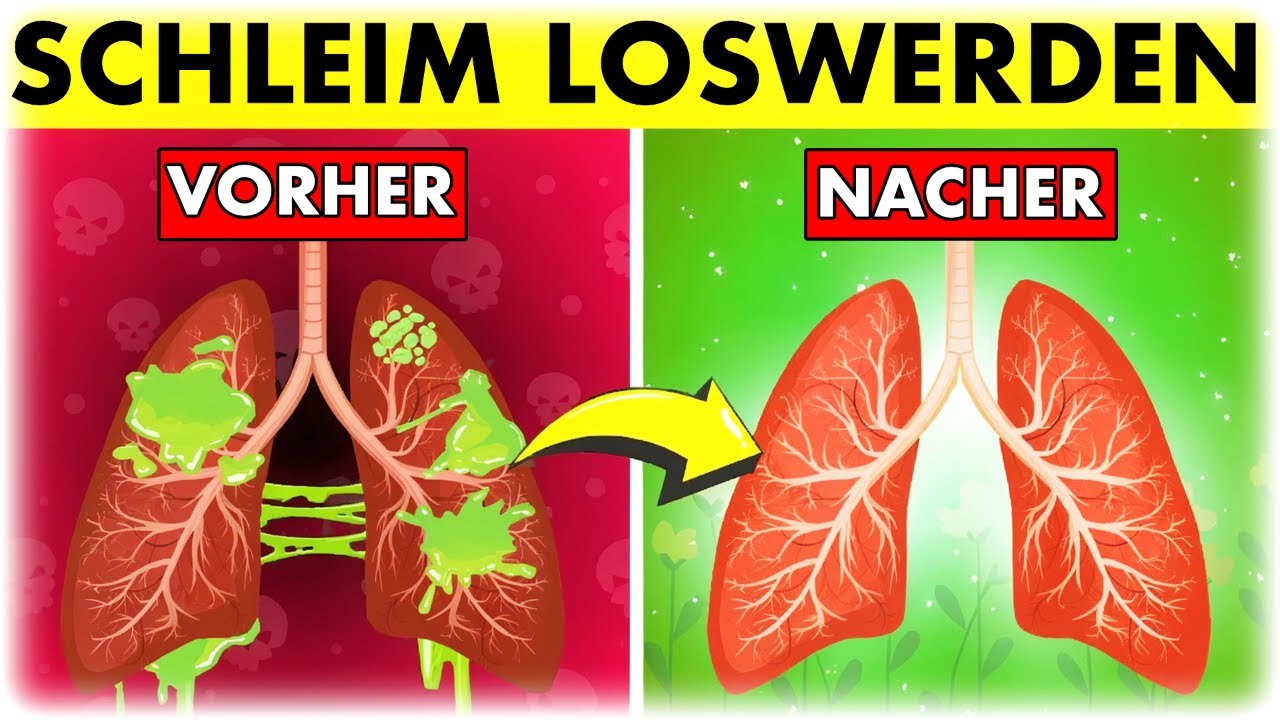 Schleim in Hals & Lunge kinderleicht l&ouml;sen: Urdeutsches-Rezept f&uuml;r freie Atemwege!