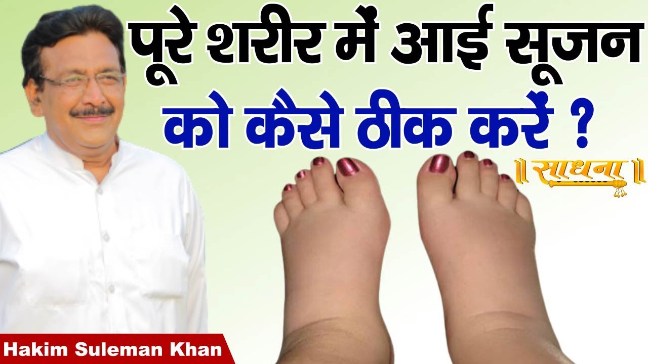 पूरे शरीर में आई सूजन को कैसे ठीक करें ? Hakim Suleman Khan | Sadhna TV