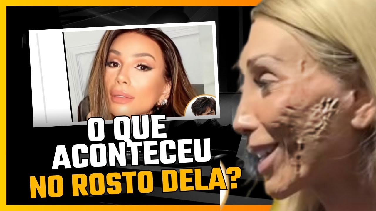 O QUE ACONTECEU no rosto da Maya Massafera? 😱 #peeling #beleza #fenol