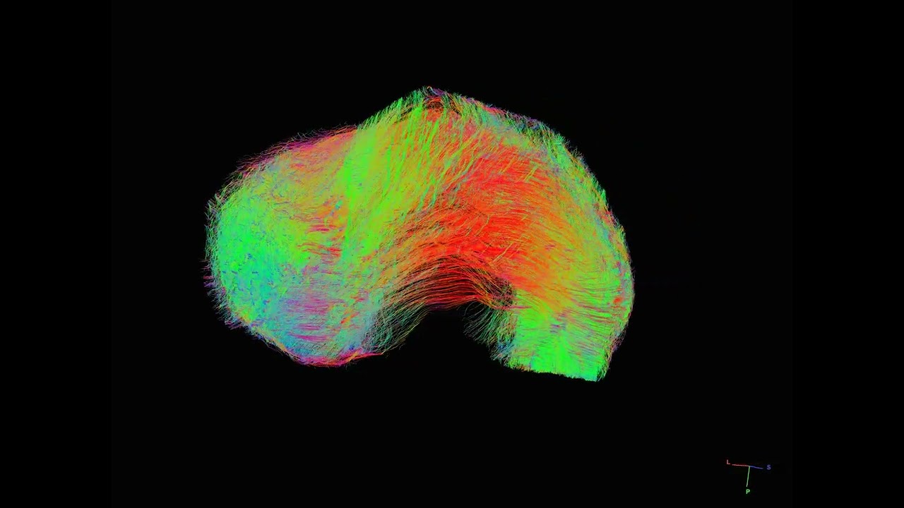 Porcine meniscus 3D collagen fibers -- diffusion tractography