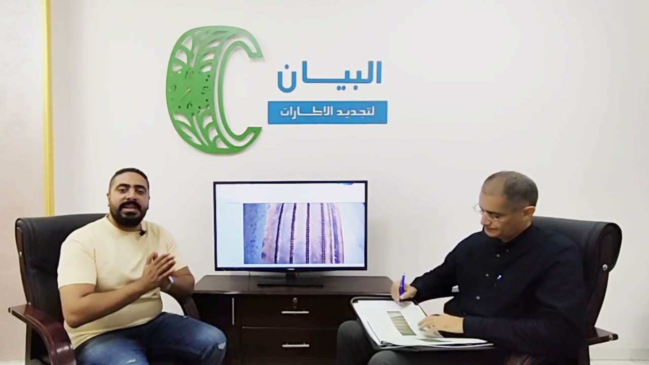 المشاكل اللي بتواجه كاوتش النقل الثقيل وازاي تتجنبها