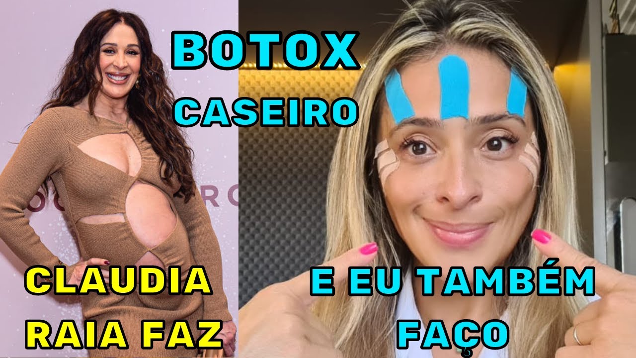 BOTOX CASEIRO! Substitua o BOTOX de forma Simples com Taping e Massagem! Vem ver como!