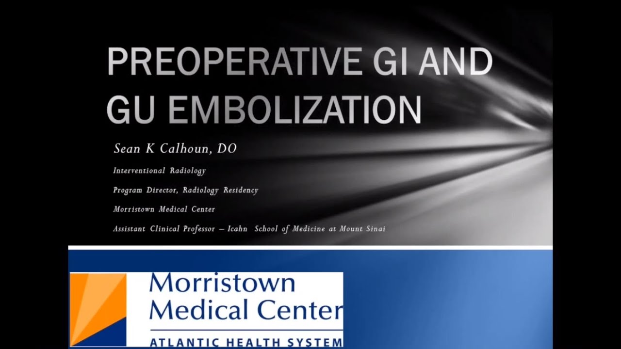 SIR-RFS Webinar (10/29/14): Pre-operative Embolization: GI, GU, and Reproductive Systems