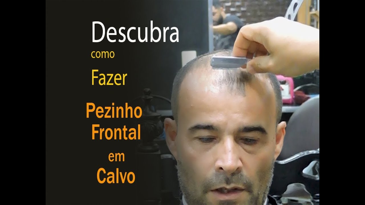 Como Fazer pezinho ou acabamento em Calvo-Calvicie