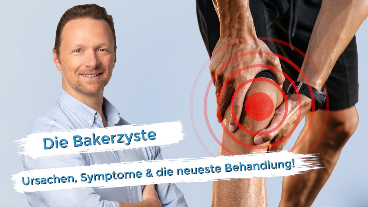 Bakerzyste - Die neueste Behandlungsmethode!