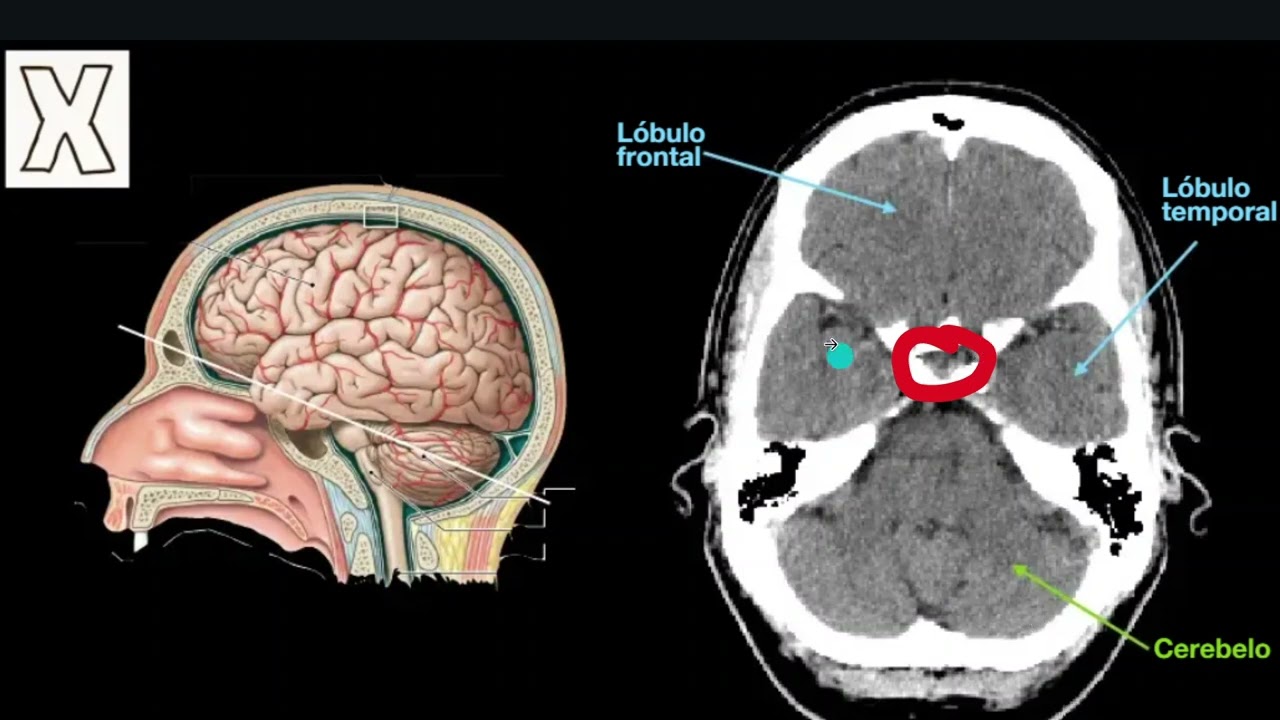 ¿Vas a jalar ANATOMÍA SECCIONAL? Mira este video antes de rendirte 😭➡️🩻
