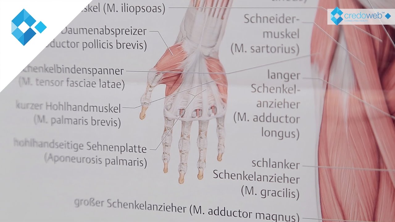 Karpaltunnelsyndrom