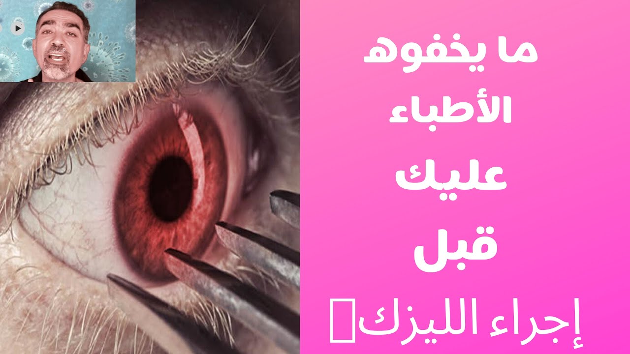ما يخفيه الأطباء عليك قبل اجراء #الليزك؟