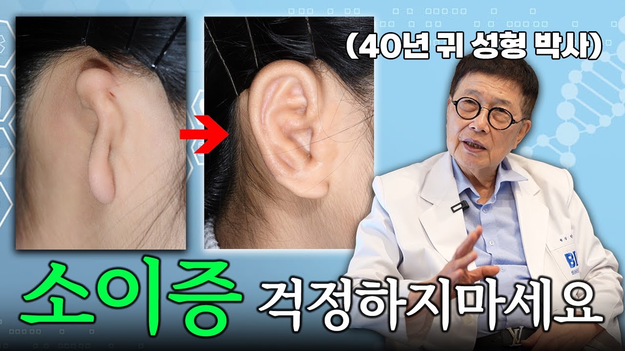 소이증의 발생원인과 수술방법에 대해서 알려드립니다