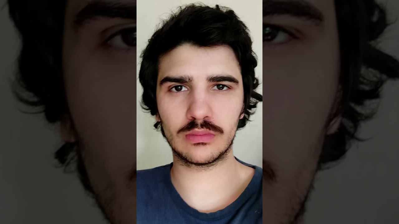 Hair Growth Time-lapse - 1 Year (Daily Selfie) 