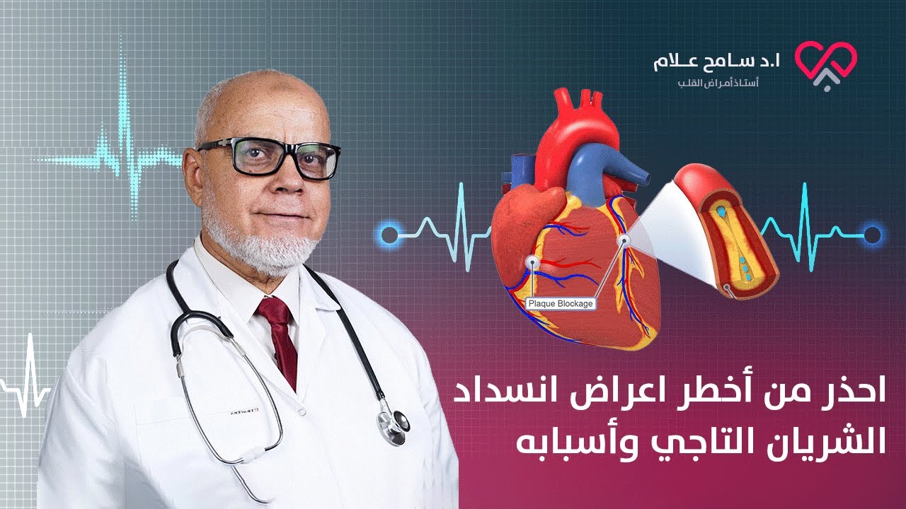 احذر من أخطر اعراض انسداد الشريان التاجي وأسبابه - دكتور سامح علام