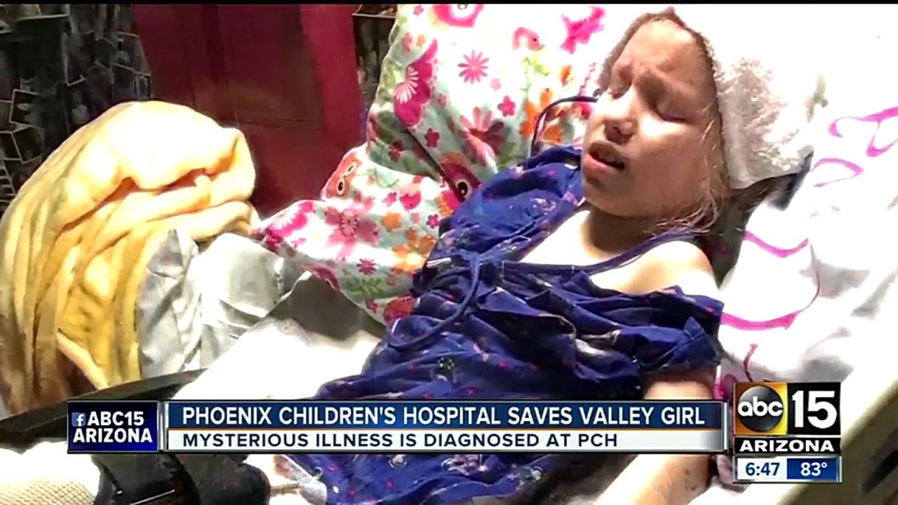 Phoenix Children's Hospital saves Valley girl