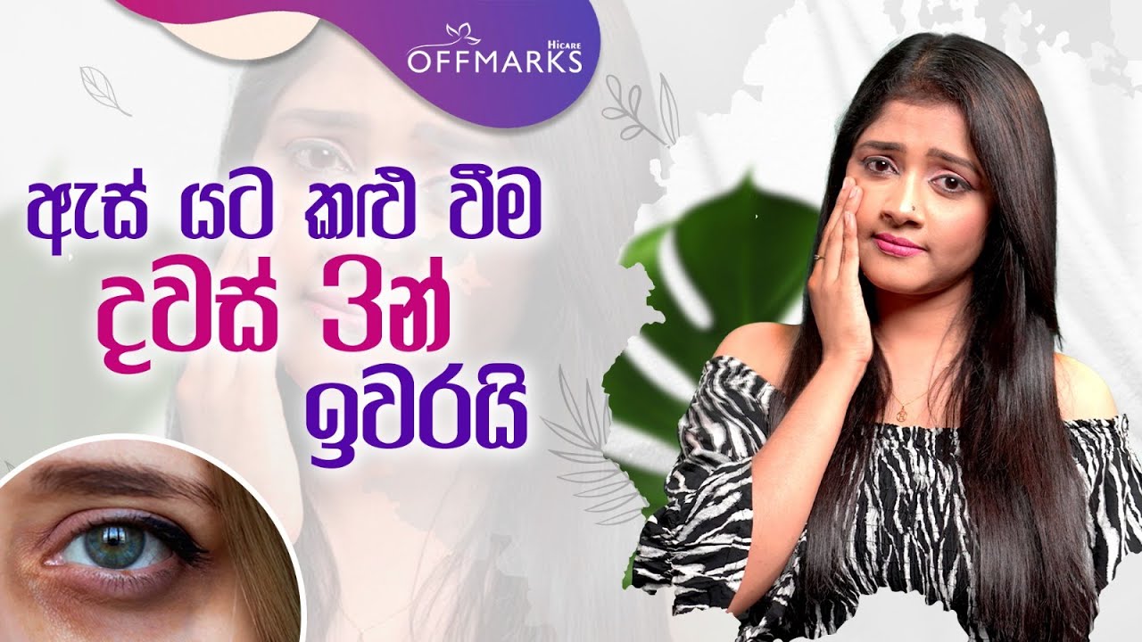 ඇස් යට අඳුරු වීම දවස් 3 න් ඉවරයි 😌❤️