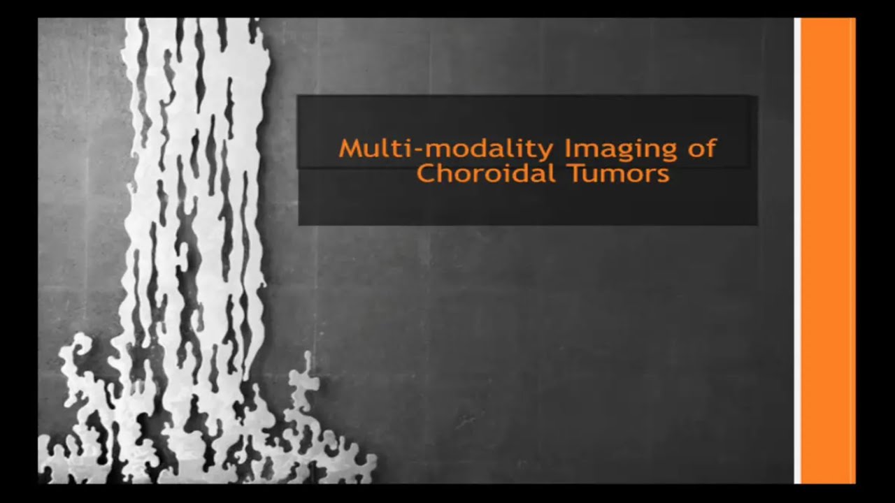 Paul T Finger MD on Multimodality Imaging of Eye Tumors: How to Make the Diagnosis